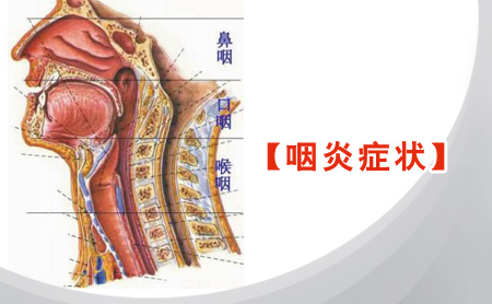 南京有治疗慢性咽炎医院吗